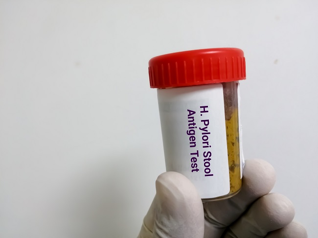 Technician,Hold,Container,With,Stool,Sample,For,H